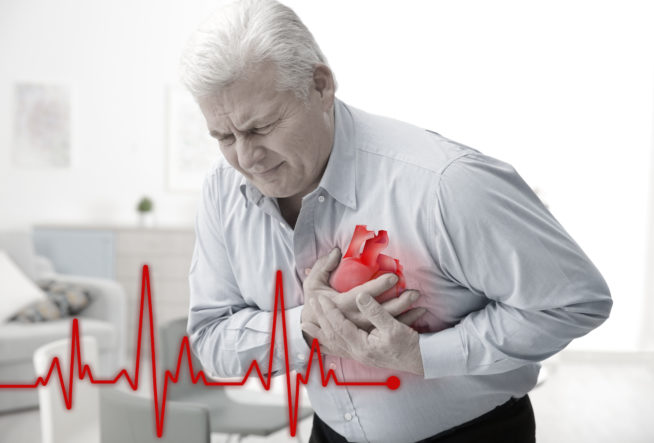 15 درصد از افراد دچار سکته قلبی از قبل علائمی ندارند